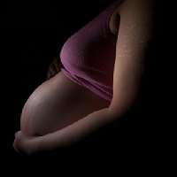 Une femme enceinte ayant des vergetures au niveau du ventre et des bras