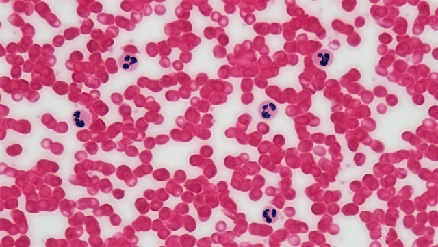 Vue microscopique leucocytes dans le sang